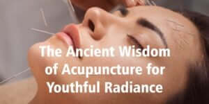 Acupuncture for Youthful radiance