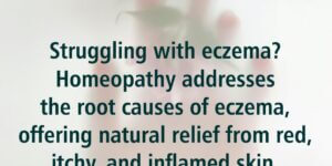 skin conditions and homeopathy