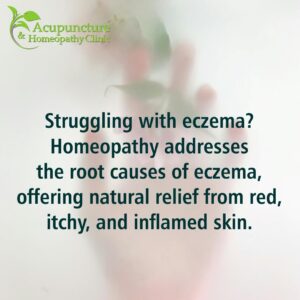 skin conditions and homeopathy