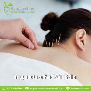 Acupuncture for pain relief